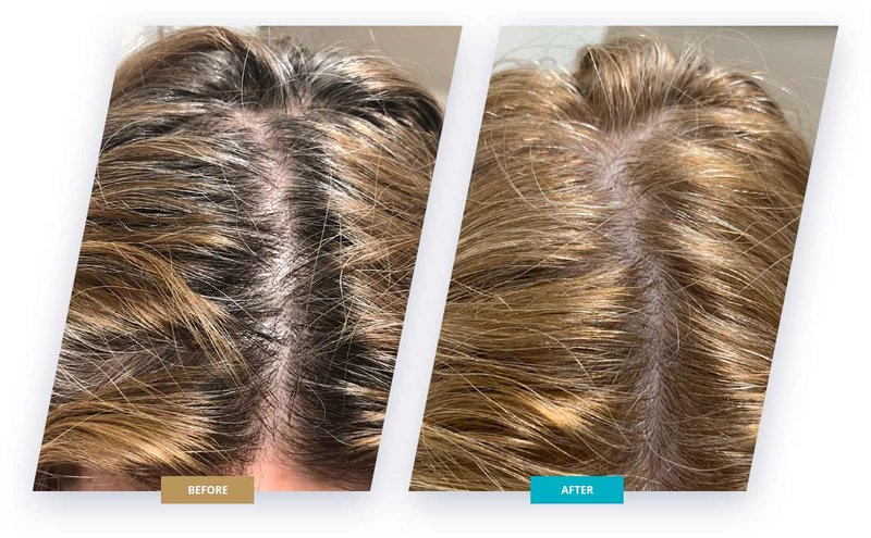 Hairstim Cena w Apteczce: Rozwiązanie dla Odwodnienia Włosów, hairstim cena w aptece Hairstim Cena w Apteczce: Rozwiązanie dla Odwodnienia Włosów, hairstim cena w aptece